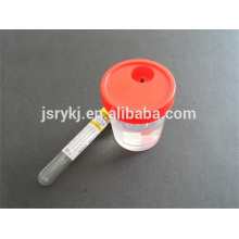 medical use 9.5ml Vacuum urine tube